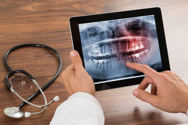 ed-time-machine teeth affected by toxins